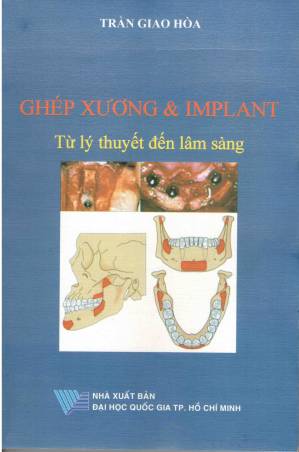 Ghép xương & Implant từ lý thuyết đến lâm sàng