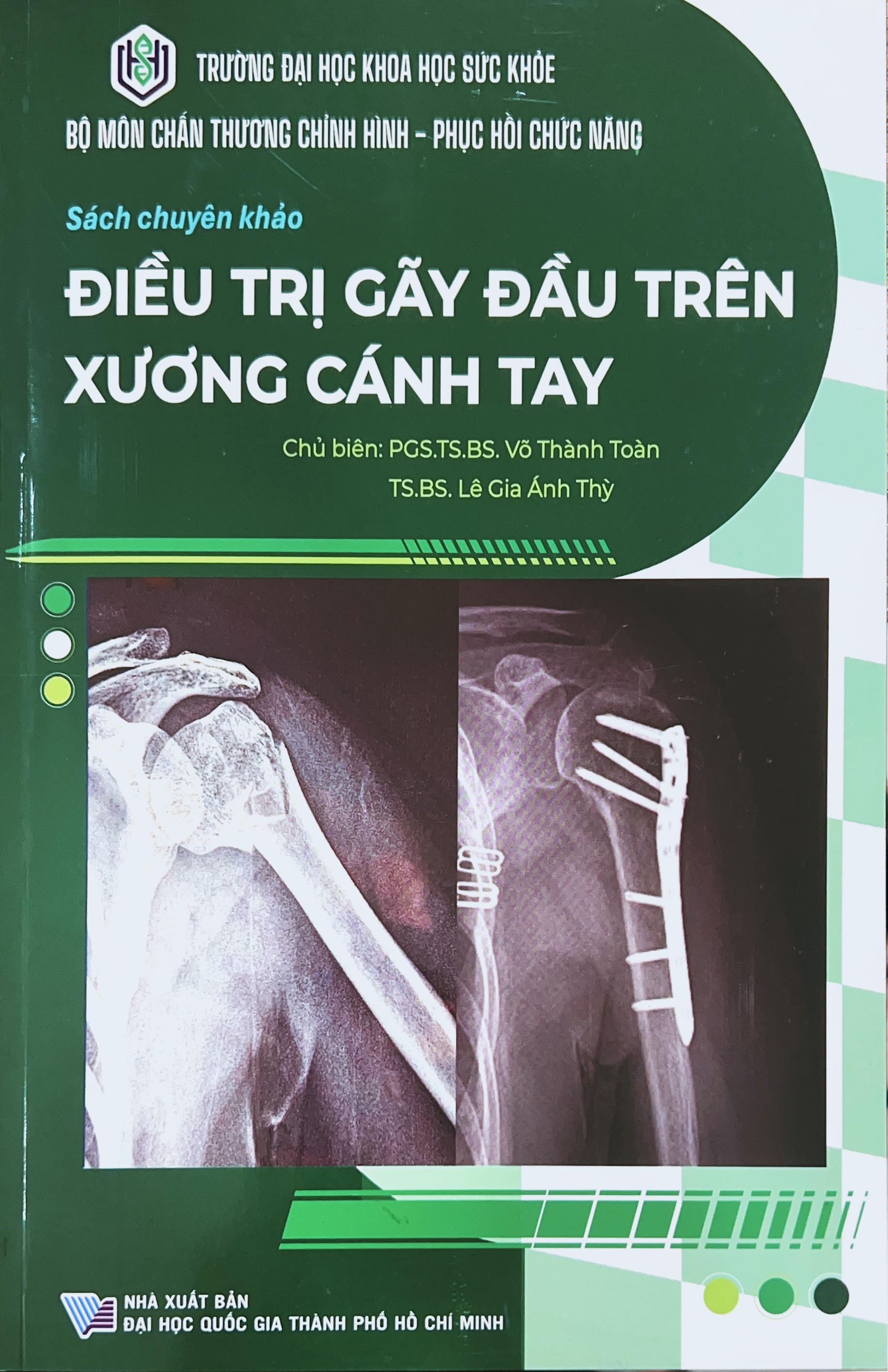 Sách chuyên khảo: Điều trị gãy đầu trên xương cánh tay